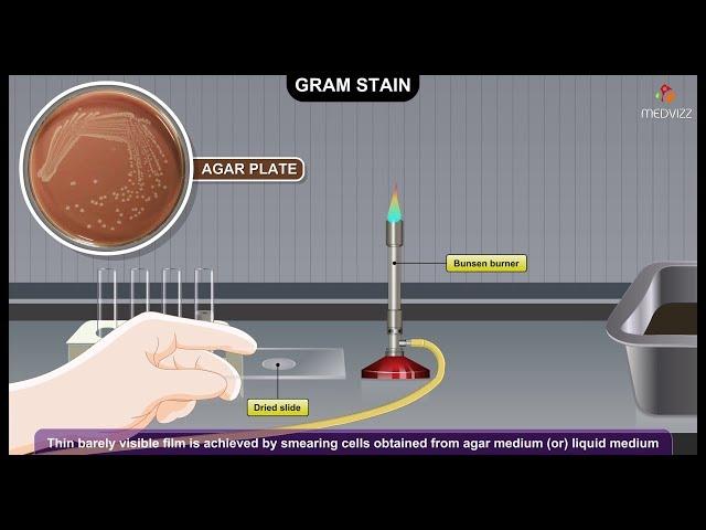 Gram Staining Procedure Animation Microbiology - Principle, Procedure, Interpretation