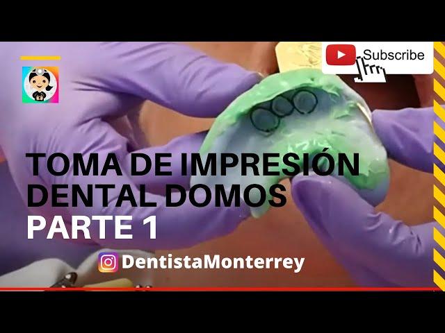 Prótesis Superior #Sobredentadura Parte1 Toma de Impersión DOMOS #protesisdental #dental