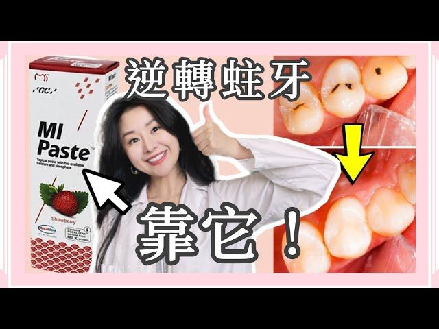 『幫牙齒補鈣』逆轉蛀牙 抗敏感 全靠MI Paste | 不知道的人 吃大虧了 @DrTeresa