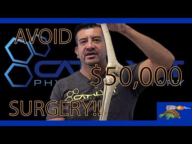 How to AVOID a $50,000 SURGERY!! - Prevent Knock Knees