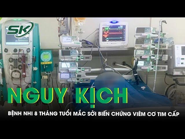 Bệnh nhi 8 tháng tuổi nguy kịch mắc sởi biến chứng viêm cơ tim cấp | SKĐS