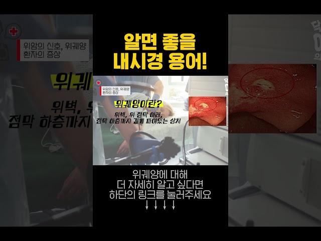 내시경 받기전 알아두면 좋은 용어들