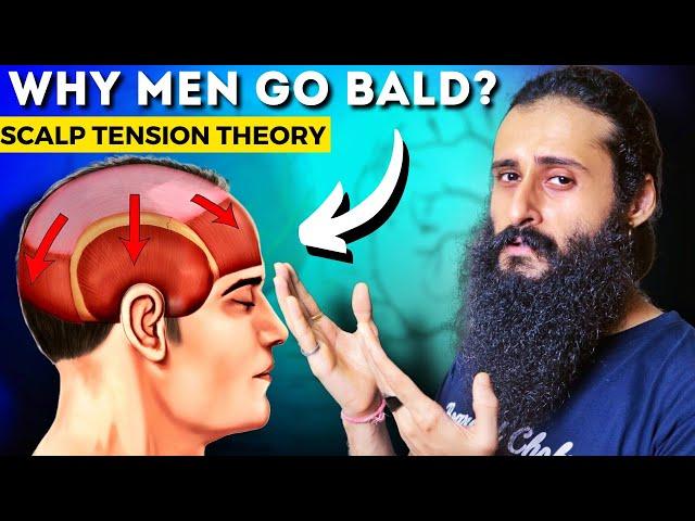 Scalp Tension Theory - The Real Reason For Hair Loss | Bearded Chokra