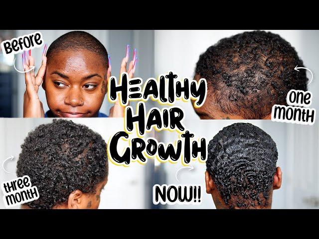 PCOS & ALOPECIA SUFFERERS THIS Is How I DOUBLED My Hair Growth Using 2 METHODS!! | Laurasia Andrea