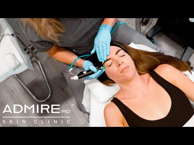 Hydrafacial Syndeo - Take Your Skin To The Next Level