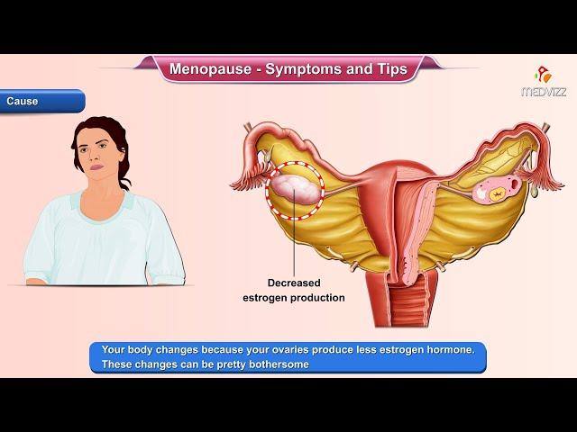 Menopause Symptoms - Ways to Deal With it