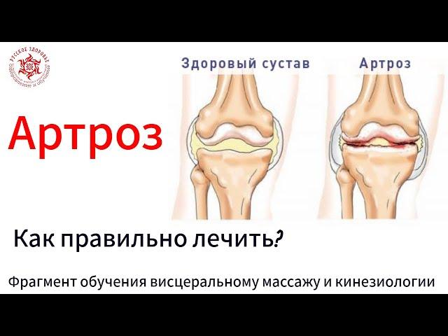 Артроз. Как правильно лечить? Фрагмент обучения висцеральному массажу и кинезиологии