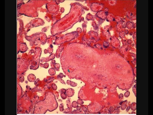 ПЛАЦЕНТА ПЛОДНАЯ ЧАСТЬ  гистологическое строение  PLACENTA