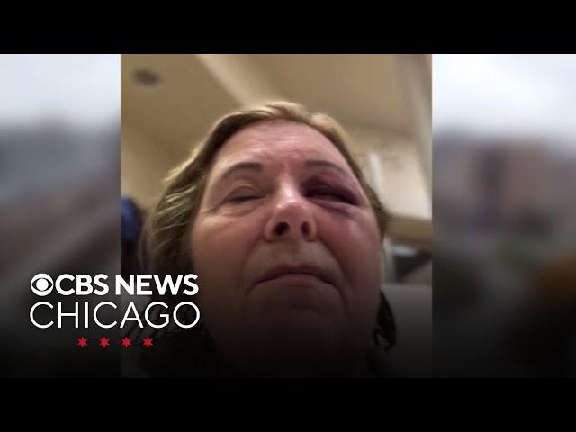 Patient's violent attack on hospital employee caught on video