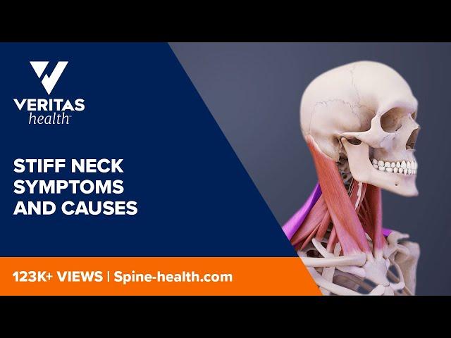 Stiff Neck Symptoms and Causes