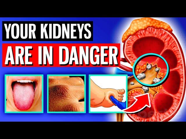 11 ALARMING Signs Your Kidneys Are Crying For Help