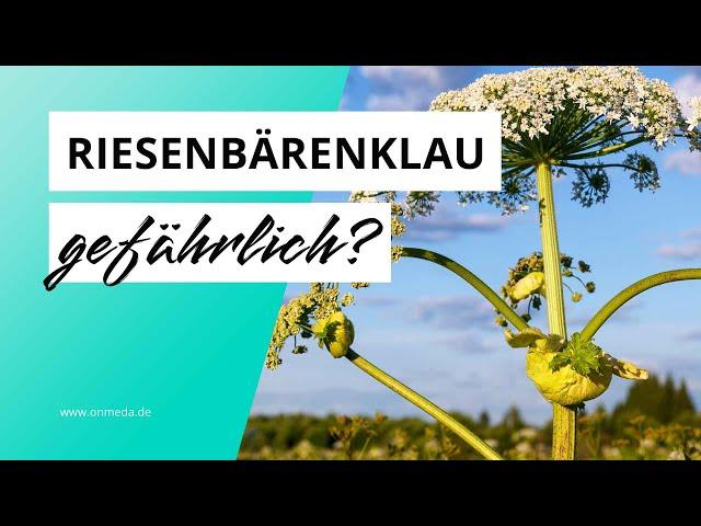 Riesenbärenklau: So gefährlich ist die Herkulesstaude