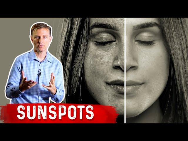 How to Get Rid of Sunspots on Your Skin