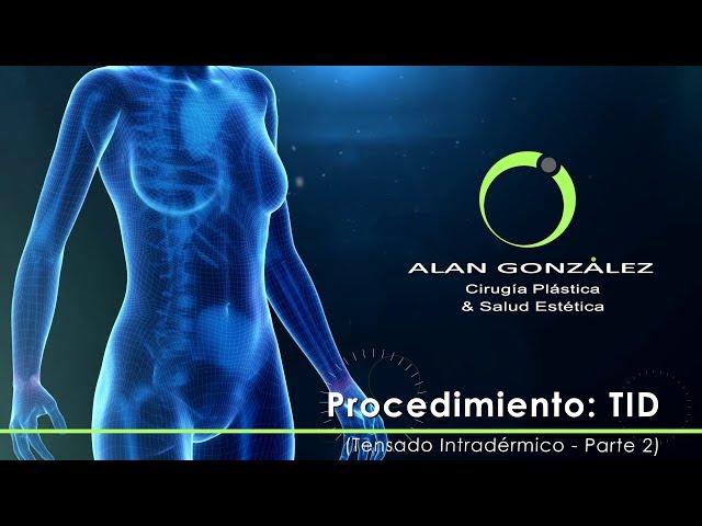 Procedimiento TID [Tensado Intradérmico] - Parte 2 - Alan González