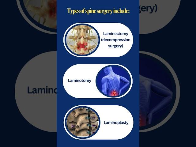 Concerned about Spinal Stenosis