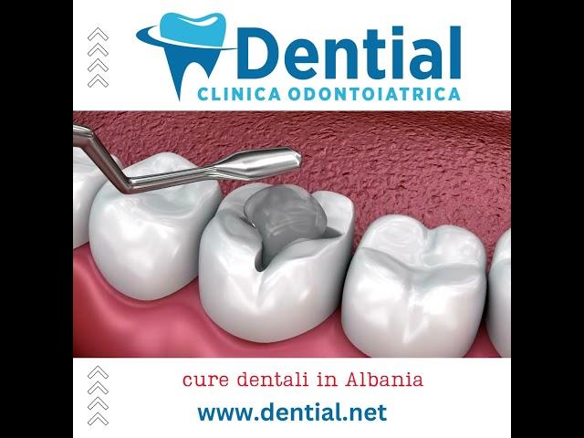 DENTIAL | cure dentali e dentisti in Albania