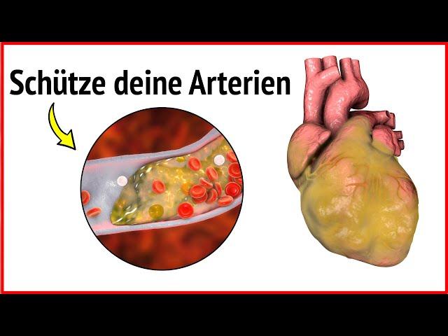 Arterien reinigen: Maximale Wirkung durch diese 4 Lebensmittel