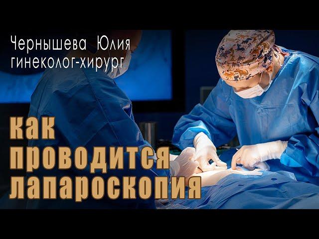 Как проводится лапароскопия