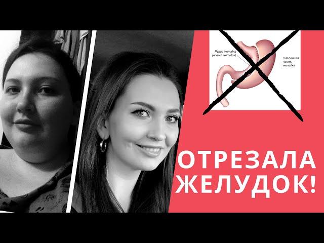 5 ЛЕТ ПОСЛЕ РЕЗЕКЦИИ ЖЕЛУДКА | ПОЖАЛЕЛА ЛИ Я | ОТЗЫВ | МОЙ ОПЫТ