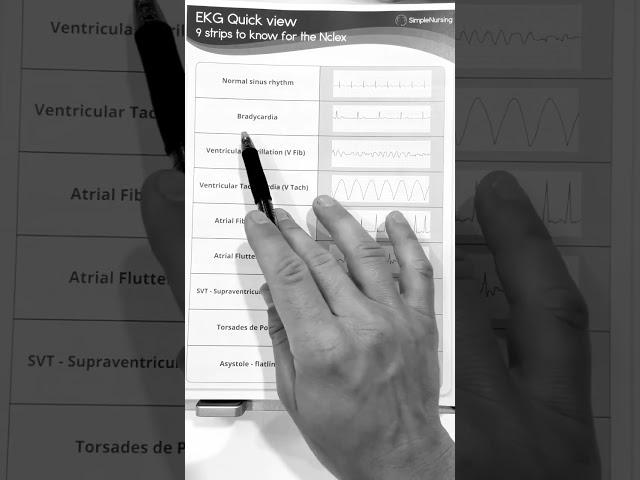 Into to ekg interpretation.