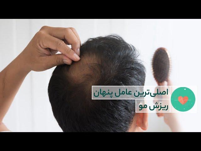 اصلی ترین عامل پنهان ریزش مو - راز سلامتی و تندرستی