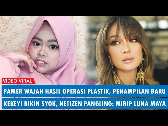 Pamer Wajah Hasil Operasi Plastik, Penampilan Baru Kekeyi Bikin Syok, Netizen: Mirip Luna Maya