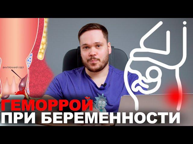 ГЕМОРРОЙ ПРИ БЕРЕМЕННОСТИ, ПРИЧИНЫ, ЛЕЧЕНИЕ, ПРОТИВОПОКАЗАНИЯ, ПРЕПАРАТЫ