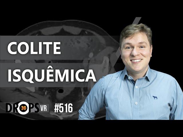 COLITE ISQUÊMICA: QUANDO PENSAR? / VOCÊ RADIOLOGISTA