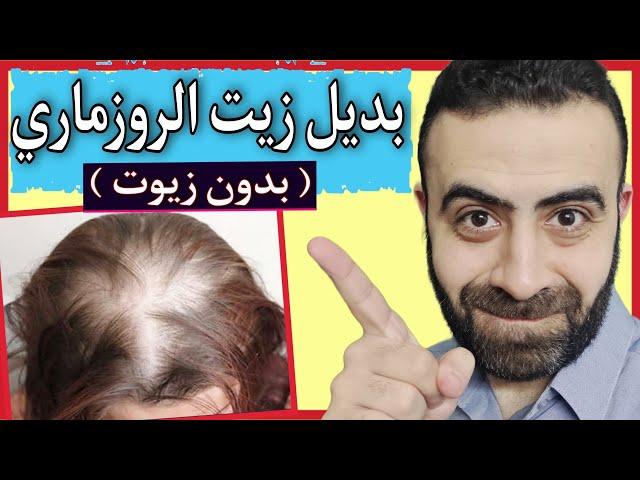 بديل زيت الروزماري / اكليل الجبل ( بدون زيوت ) لعلاج الصلع و تساقط الشعر