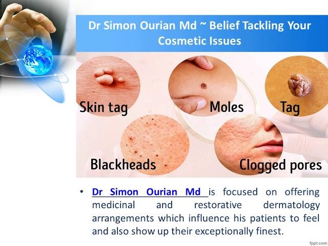 Dr Simon Ourian Md   Help With Skin, Hair, Or Nail Issues That Impact Our Patients' With Excellence