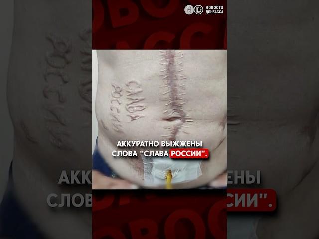 “Слава России” - шрам на теле украинского военнопленного - настоящий.