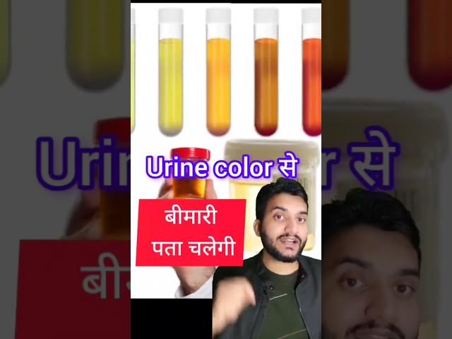 urine color and disease