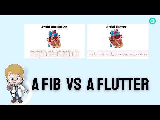 Atrial Fibrillation (aFib) Vs Atrial Flutter (aFlutter): ECG Review