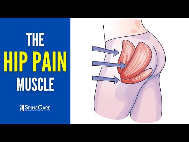 The Hip Pain Muscle (How to Release It for INSTANT RELIEF)