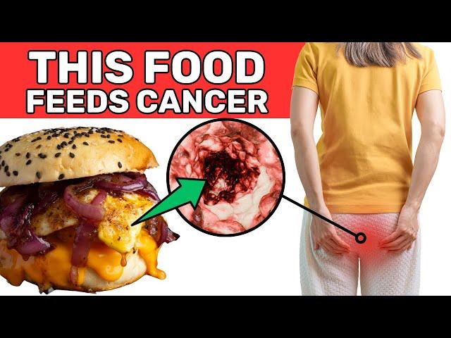 99% Eat This Daily, Unknowingly Feeding Cancer Cells!