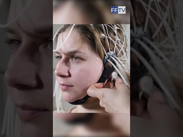 ЛЕЧЕНИЕ ЭПИЛЕПСИИ #здоровье #медицина #эпилепсия #лечение #фондфилатова #shorts #долголетие