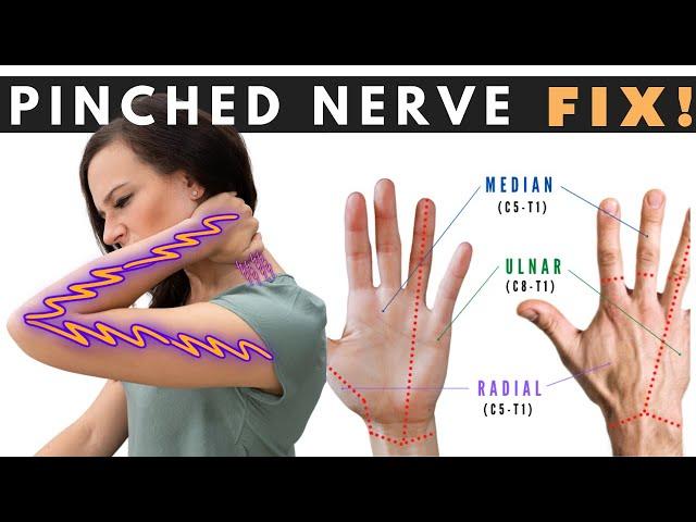 How to Fix a Pinched Nerve in the Neck | Dr. Jon Saunders