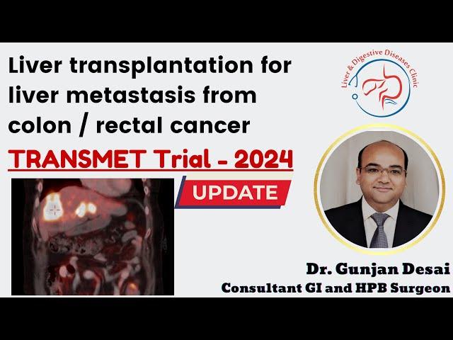 Hope for Cancer Patients: Liver Transplant for Colorectal Liver Metastasis - TRANSMET Trial