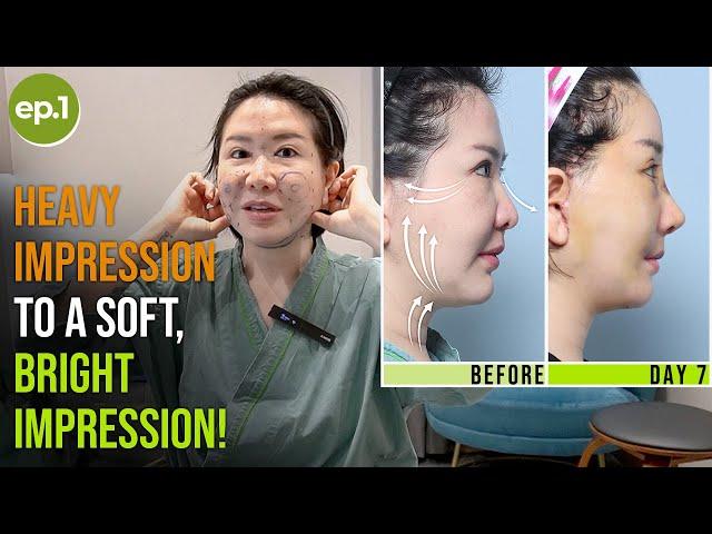 Strong and Heavy Impression to a Soft, Bright Impression through Multiple Surgeries! | Forehead Lift