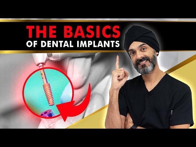 Dental Implants 101 - What you need to know