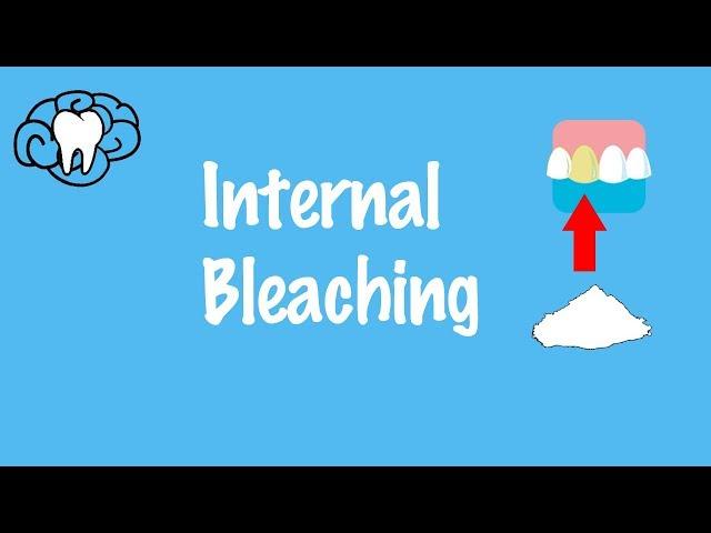 Internal Bleaching