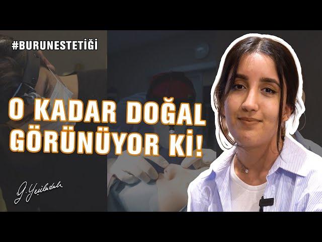 Burun Ameliyatı Olduğuma İnanmıyorlar! Burun Ameliyatı Op. Dr. Güray Yeşiladalı