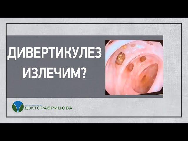 ДИВЕРТИКУЛЕЗ можно ли вылечить?