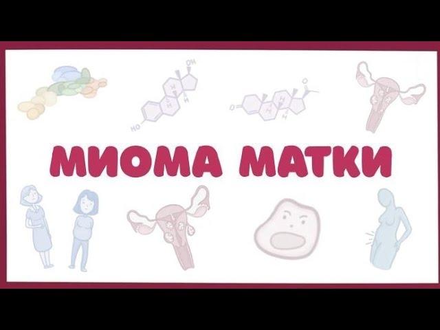 Миома матки - причины, симптомы, диагностика, лечение (гинекология) лекция