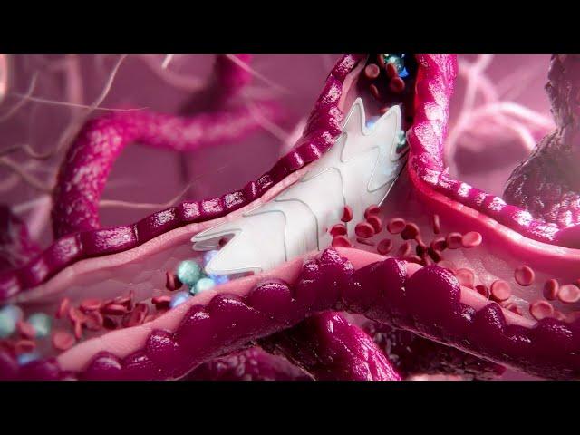 Medical Devices Animation Highlight Reel | Random42