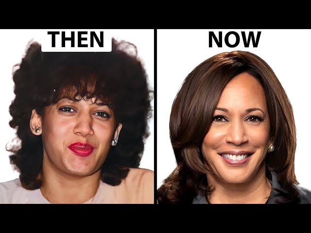 Kamala Harris NEW FACE | Plastic Surgery Analysis