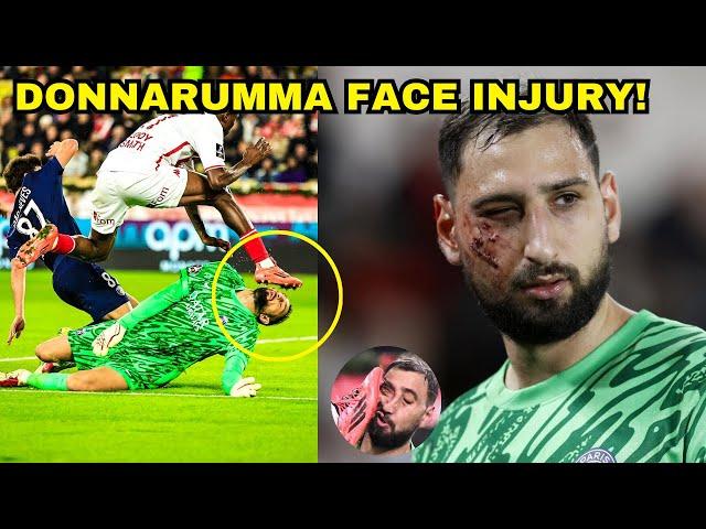 Donnarumma Horrific Face Injury During PSG 4-2 v AS Monaco