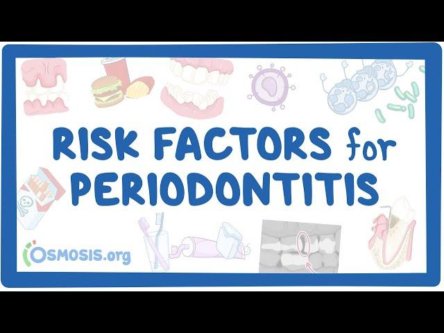 Risk Factors for Periodontitis