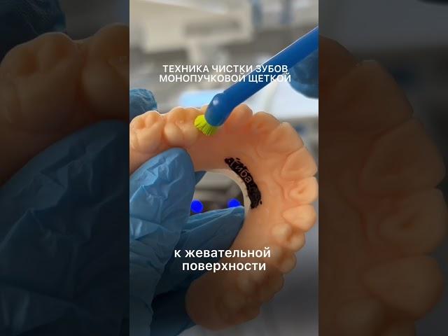 Техника чистки зубов монопучковой щеткой