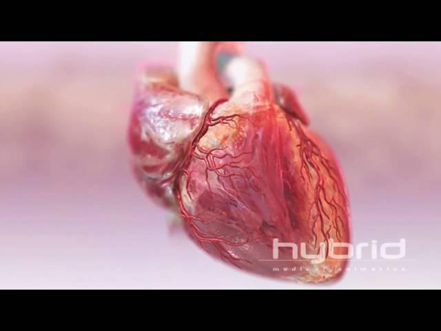 hybrid heart with blood flow HD